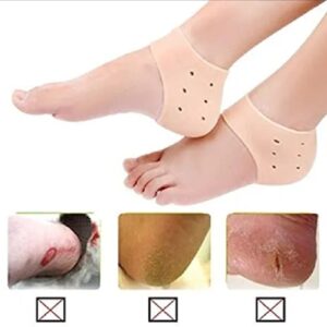 heel crack